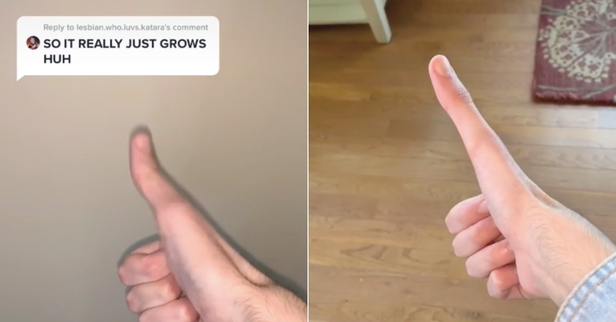 thumbs